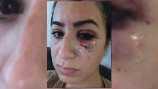 Uber driver punches woman in the face